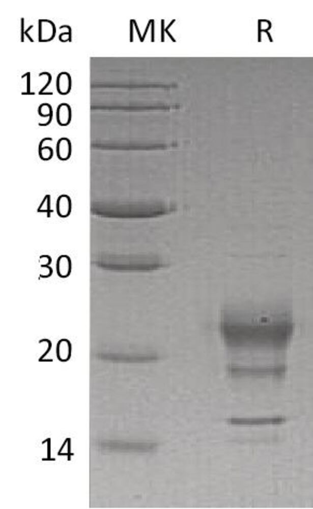 Recomb Human Interferon gamma Protein, 50 µg - Luminix Health