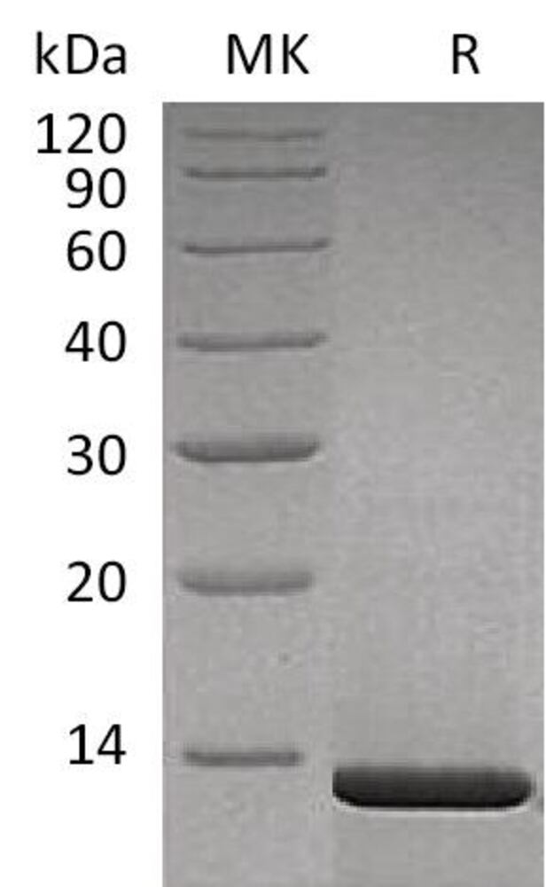 Recomb Human b Nerve Growth Factor Prot, 50 µg - Luminix Health