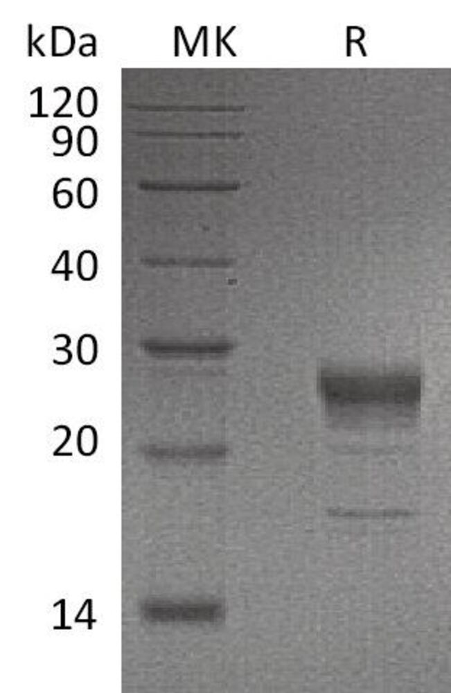 Recomb Human KGF/FGF-7 Prot (6xHis Tag), 50 µg - Luminix Health