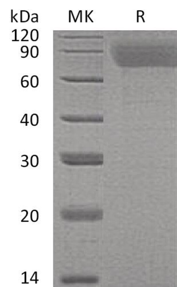 Recomb Hum Thrombopoietin Prot 6xHisTag, 50 µg - Luminix Health