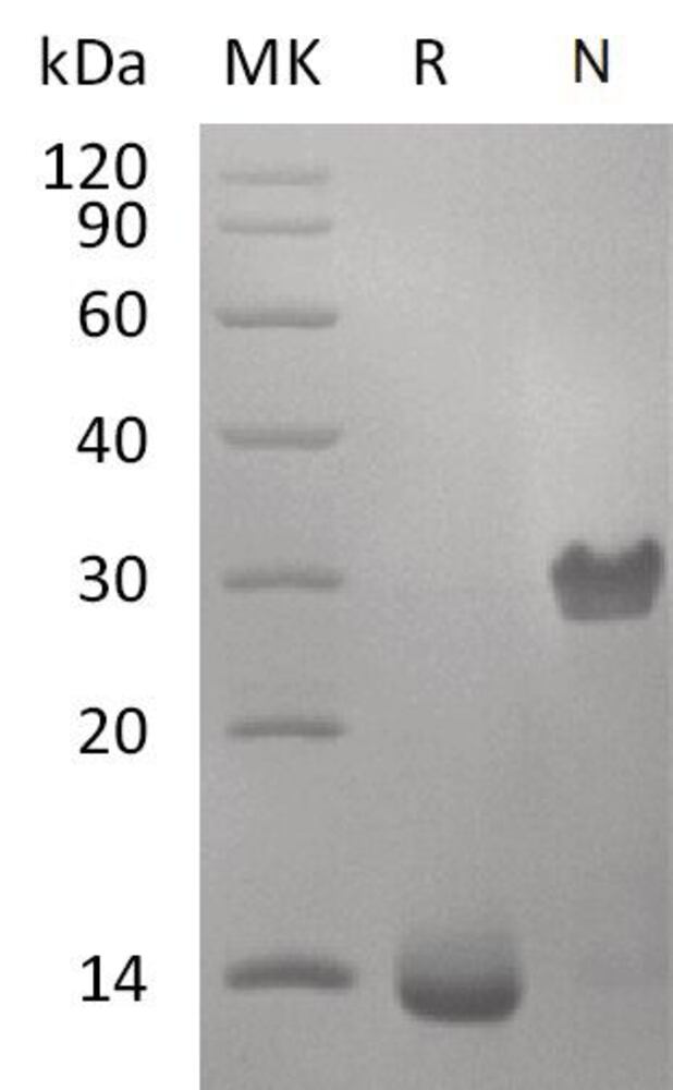 Recombinant Human PDGF B Protein, 50 µg - Luminix Health