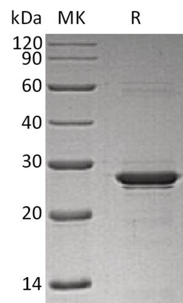RecombHum Oncostatin M/OSM Prot 6xHisTag, 50 µg - Luminix Health