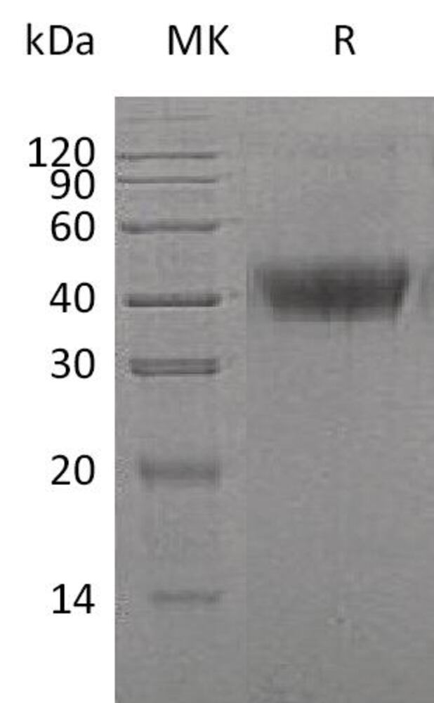 Recomb Human M-CSF Prot (6xHis Tag), 50 µg - Luminix Health