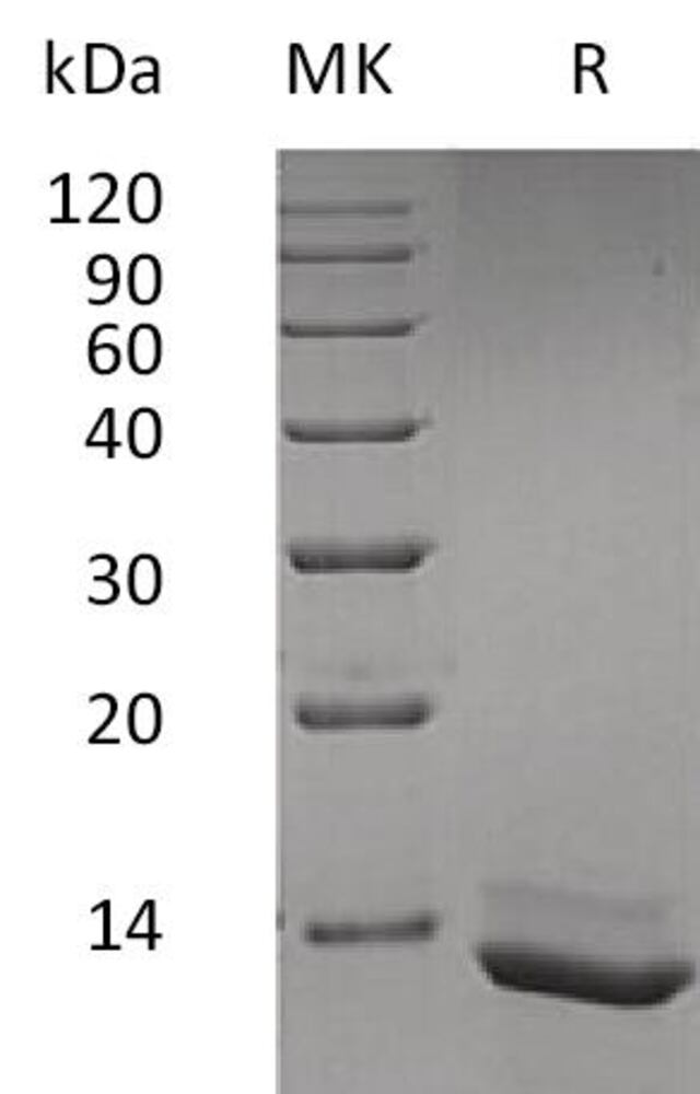 Recombinant Human IL-15 Protein, 50 µg - Luminix Health
