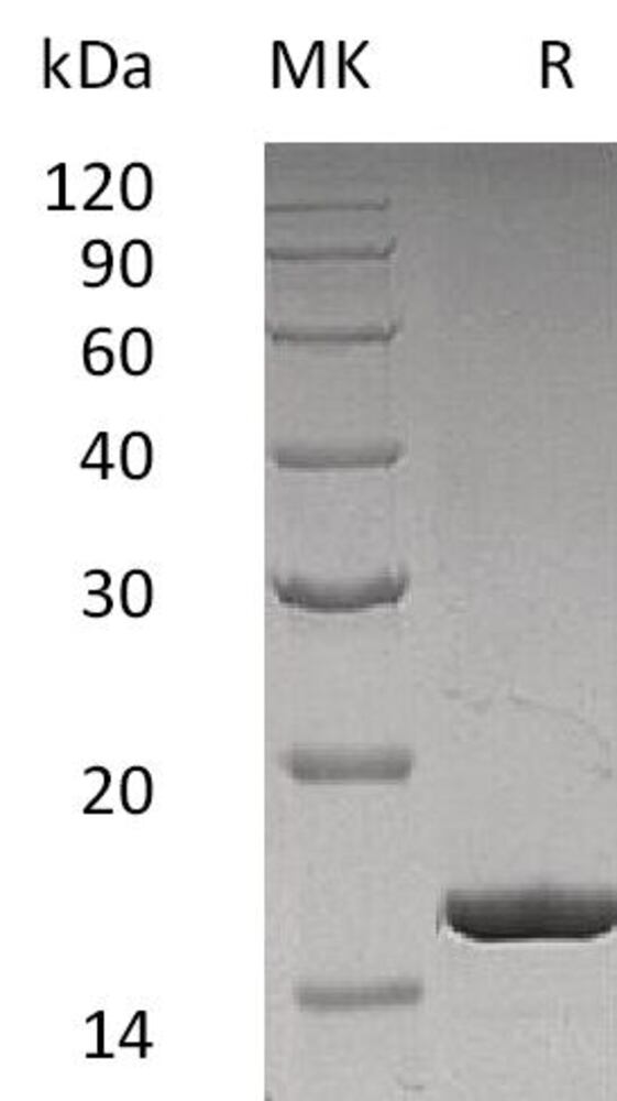 Recombinant Human G-CSF Protein, 50 µg - Luminix Health
