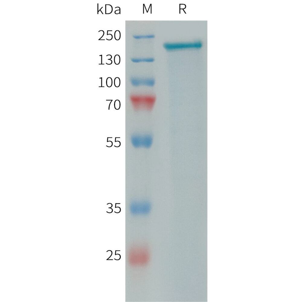 Recomb Human PLA2R Prot (10xHis Tag), 50 µg - Luminix Health