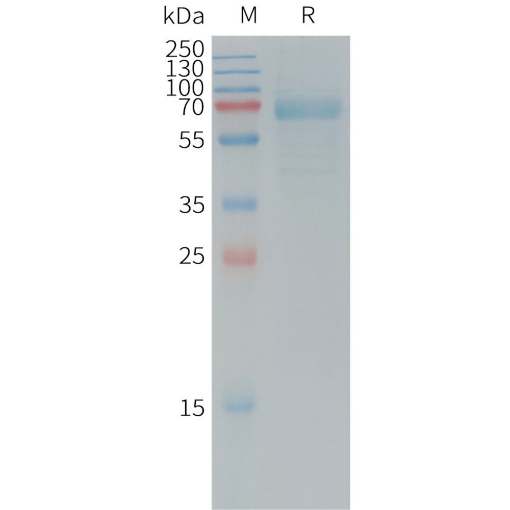 Recombinant Human DKK1 Protein (Fc Tag), 50 µg - Luminix Health
