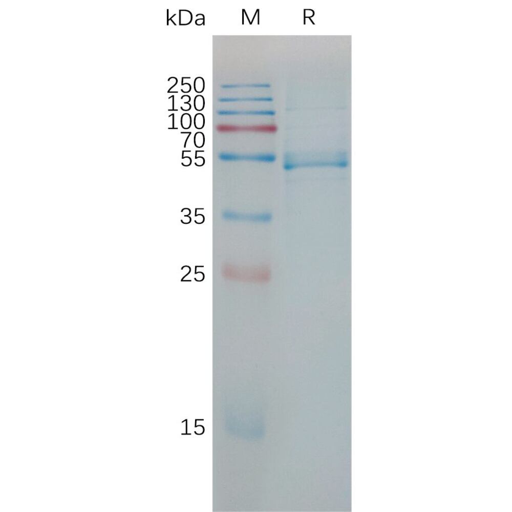 Recombinant Human IL-23 Protein (Fc Tag), 50 µg - Luminix Health