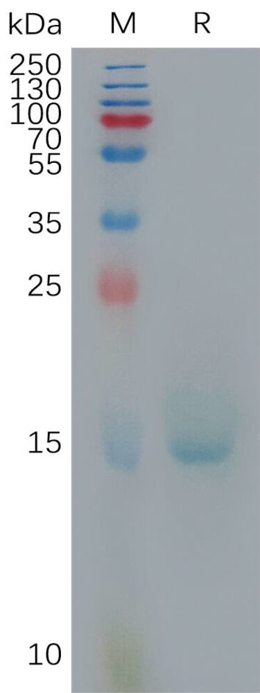 Recomb Human IL-10 Prot (6xHis Tag), 50 µg - Luminix Health