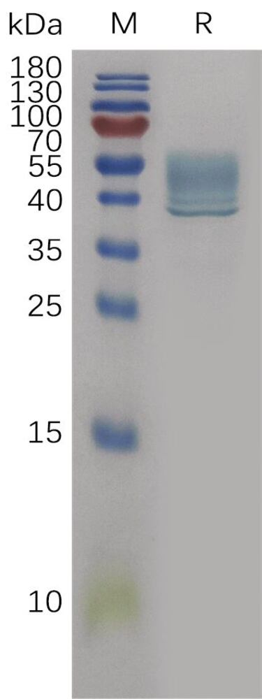 Recombinant Human IL-13 Protein (Fc Tag), 50 µg - Luminix Health