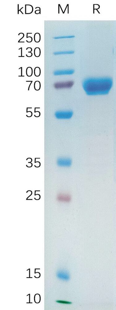 Recombinant Human NRG1 Protein (Fc Tag), 50 µg - Luminix Health