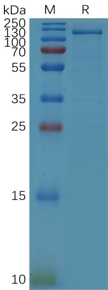 Recombinant Human HGF Protein (Fc Tag), 50 µg - Luminix Health