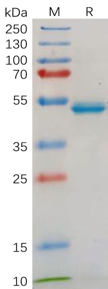 Recombinant Human IL-18 Protein (Fc Tag), 50 µg - Luminix Health