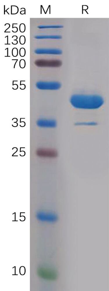 Recomb Human IL-1 alpha Protein (Fc Tag), 50 µg - Luminix Health