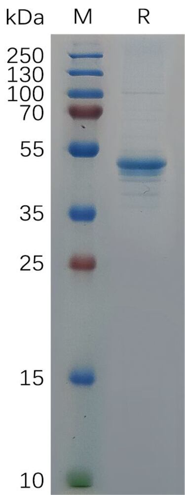 Recombinant Human GDNF Protein (Fc Tag), 50 µg - Luminix Health