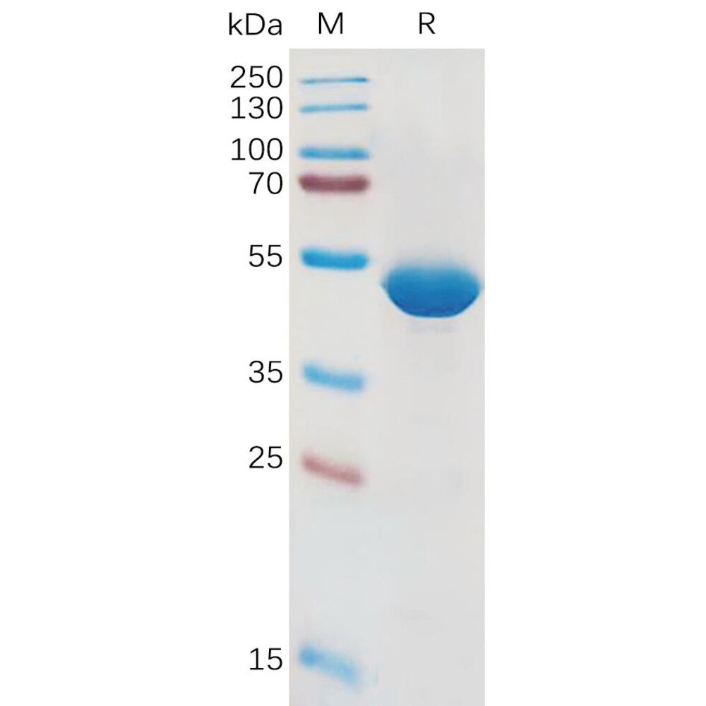 Recomb Human IL-1 beta Prot (Fc Tag), 50 µg - Luminix Health