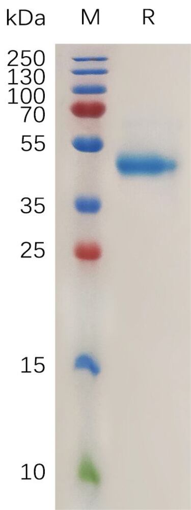 Recombinant Human RSPO1 Protein (Fc Tag), 50 µg - Luminix Health