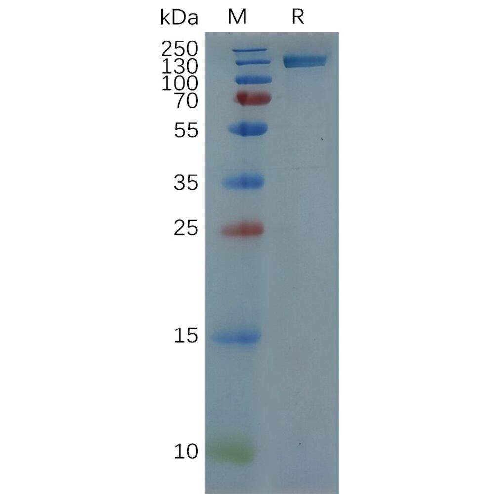 Recomb Human ErbB2/HER2 Protein (Fc Tag), 50 µg - Luminix Health