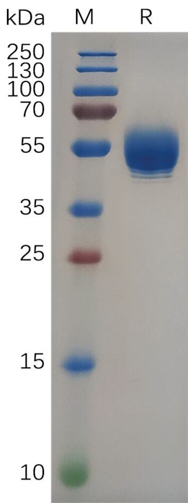 Recombinant Human IL-22 Protein (Fc Tag), 50 µg - Luminix Health