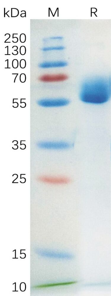 Recombinant Human SCF Protein (Fc Tag), 50 µg - Luminix Health