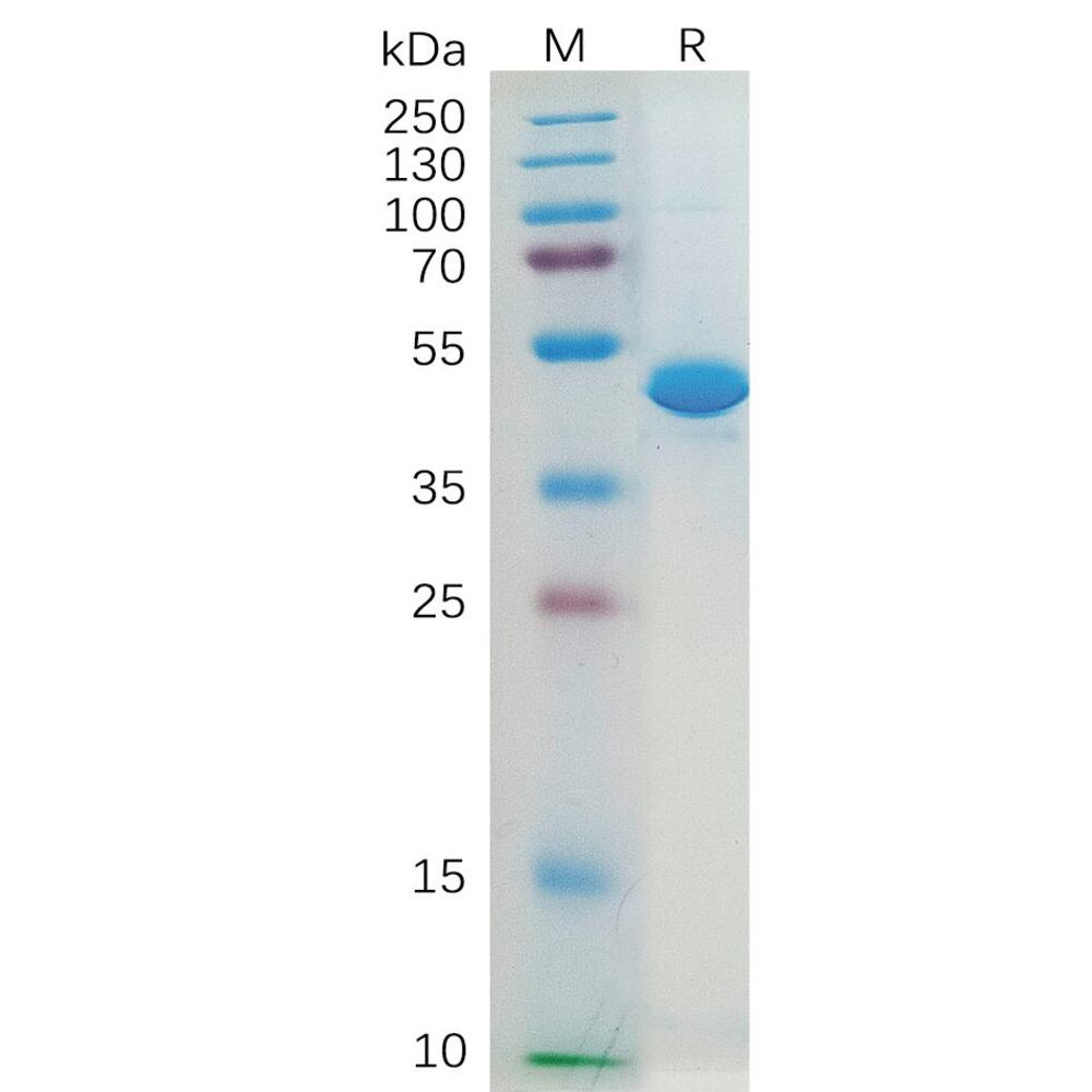 Recombinant Human IL-2 Protein (Fc Tag), 50 µg - Luminix Health