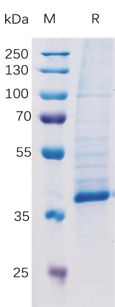 Recomb Human TGF beta 1 Prot (Fc Tag), 50 µg - Luminix Health