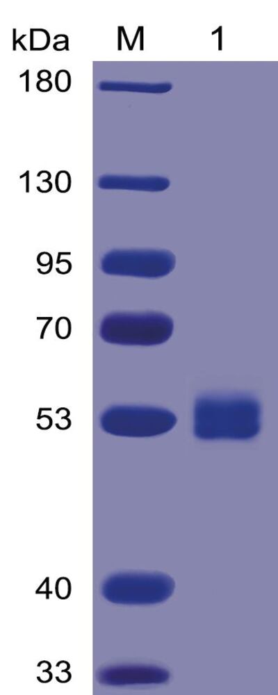 Recomb Hum IL6 Prot (FcChimera 6xHisTag), 50 µg - Luminix Health
