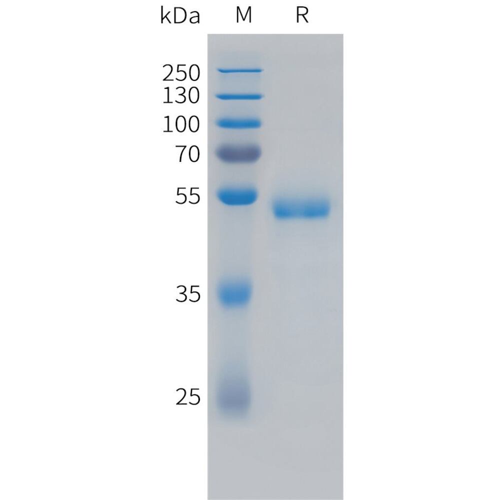 Recomb Human VEGF165 Protein (Fc Tag), 50 µg - Luminix Health