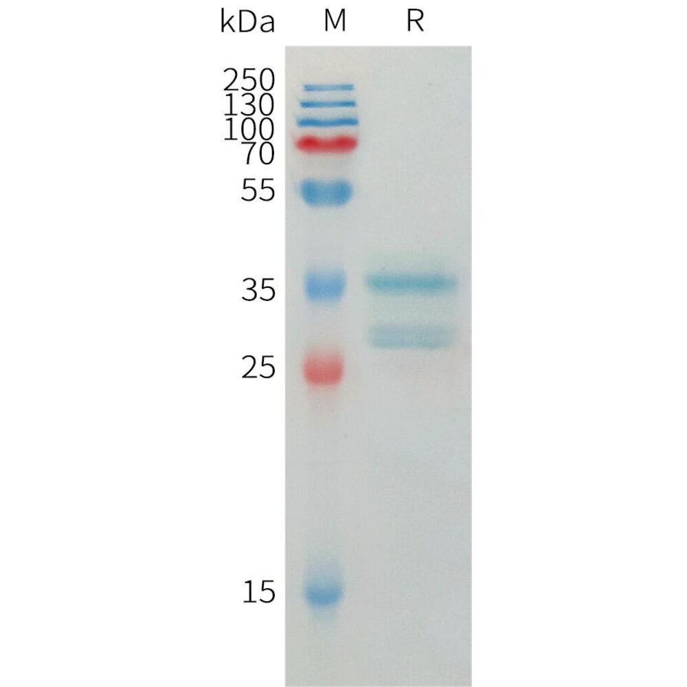 Recombinant Human IP10 Protein (Fc Tag), 50 µg - Luminix Health