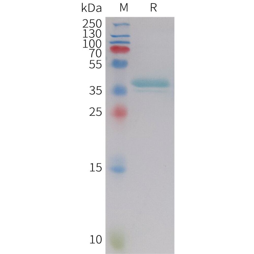 Recomb Human Leptin Prot (Fc Tag), 50 µg - Luminix Health