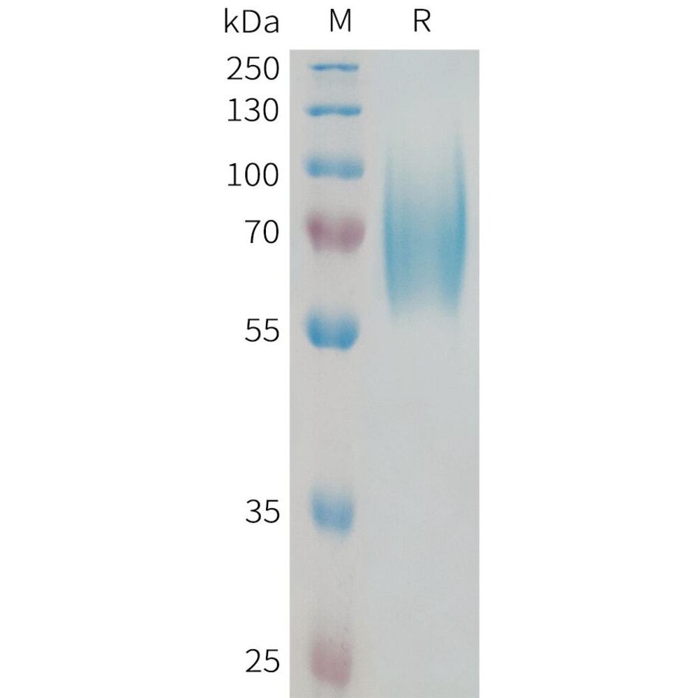 Recomb Human TrkB Protein (6xHis Tag), 50 µg - Luminix Health