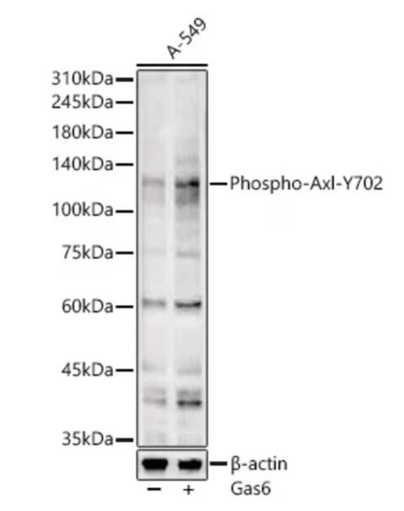 Donkey Anti-Goat IgG H&L Antibody (FITC), 100 µl
