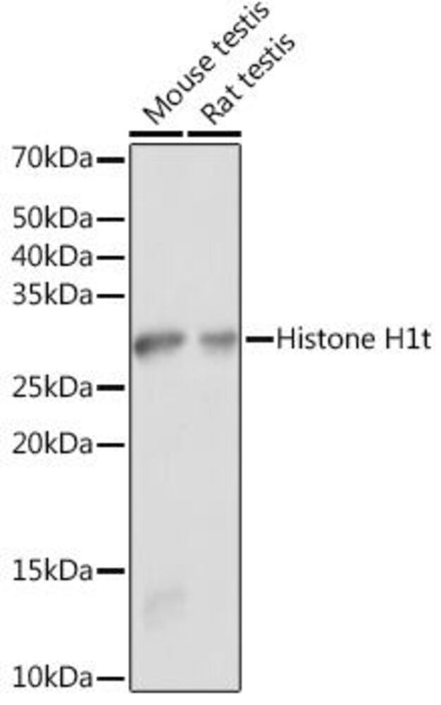 Anti-Histone H1 Antibody, 100 µl