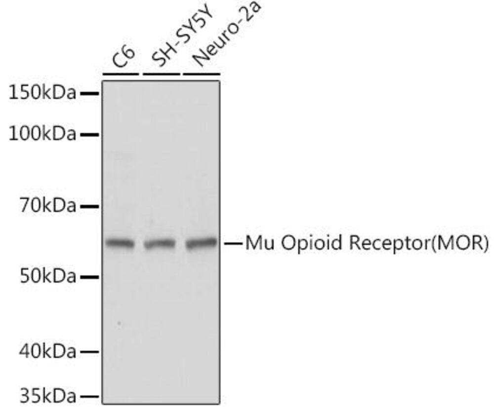 Anti-Mu Opioid Receptor Antibody, 100 µl