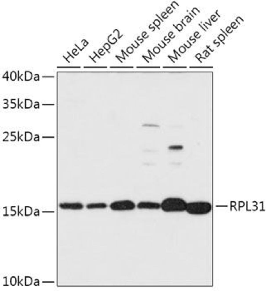 Anti-RPL31 Antibody