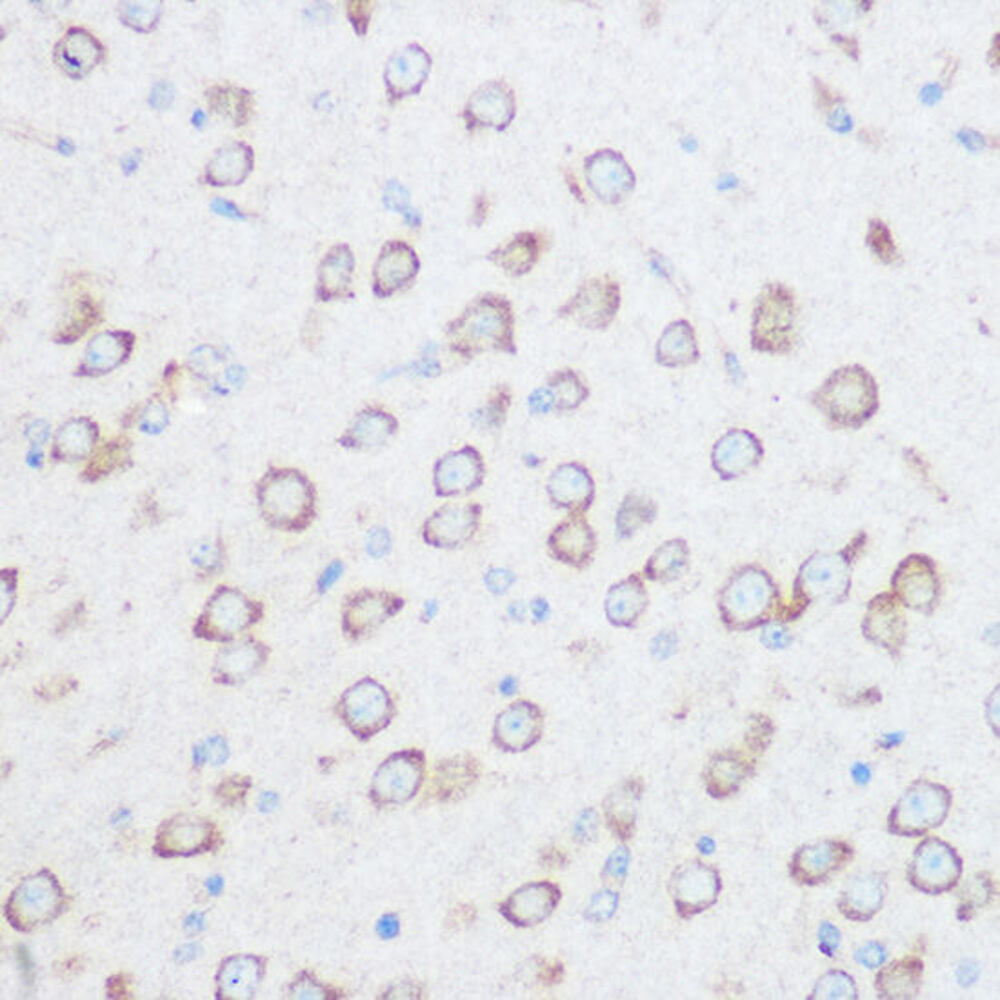 Anti-NG2 Antibody, 100 µl