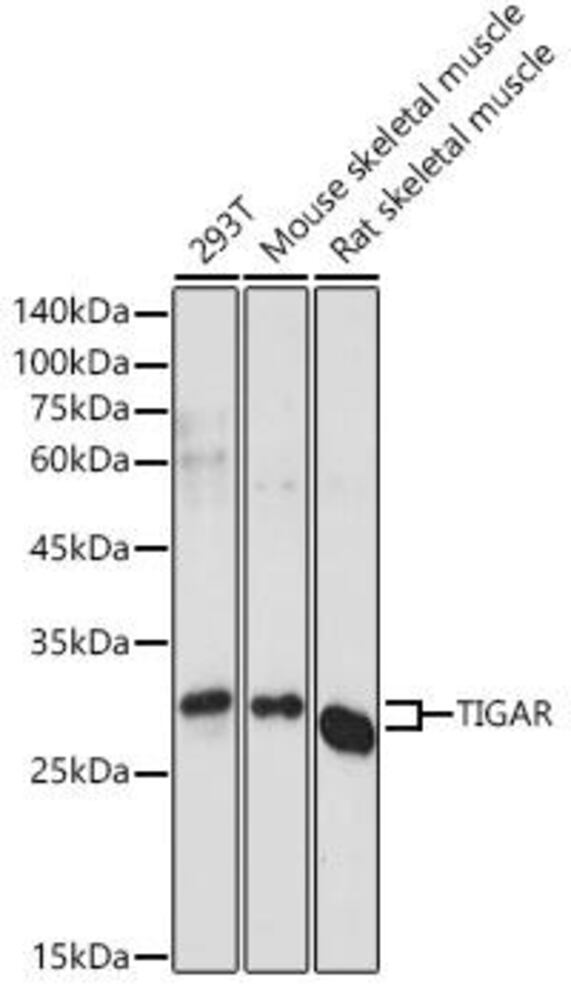 Anti-TIGAR Antibody