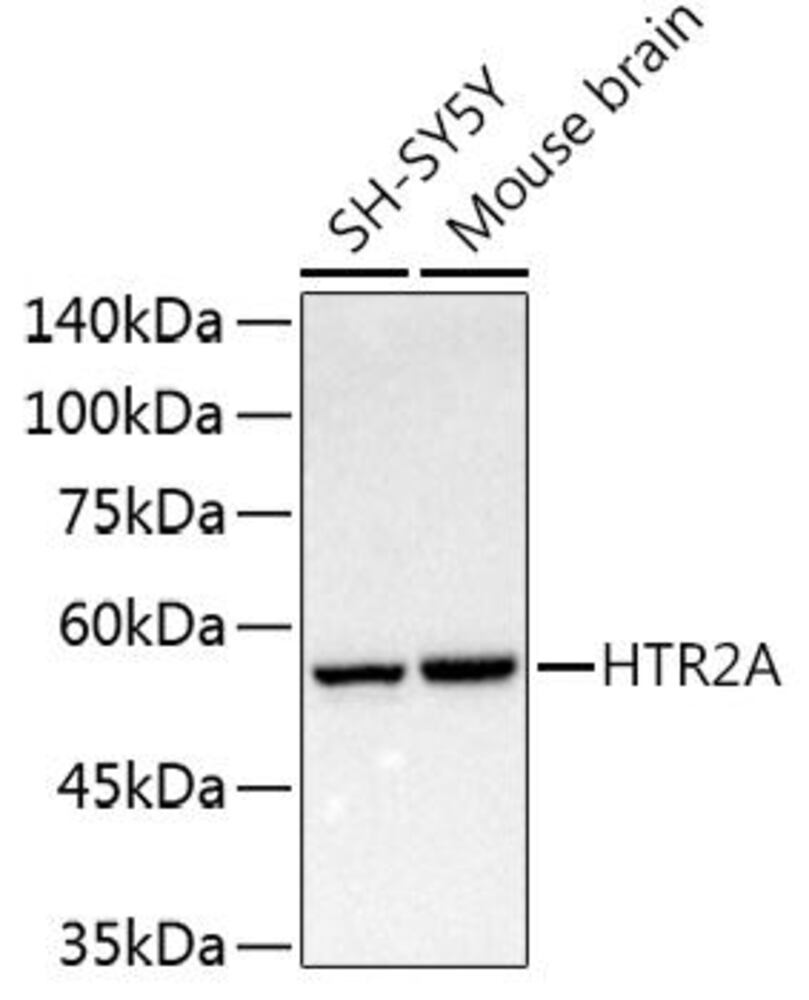 Anti-5HT2A Receptor Antibody