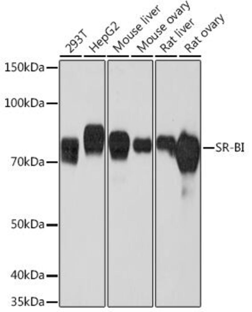 Anti-Scavenging Receptor SR-BI Antibody, clone ARC0334, 100 µl