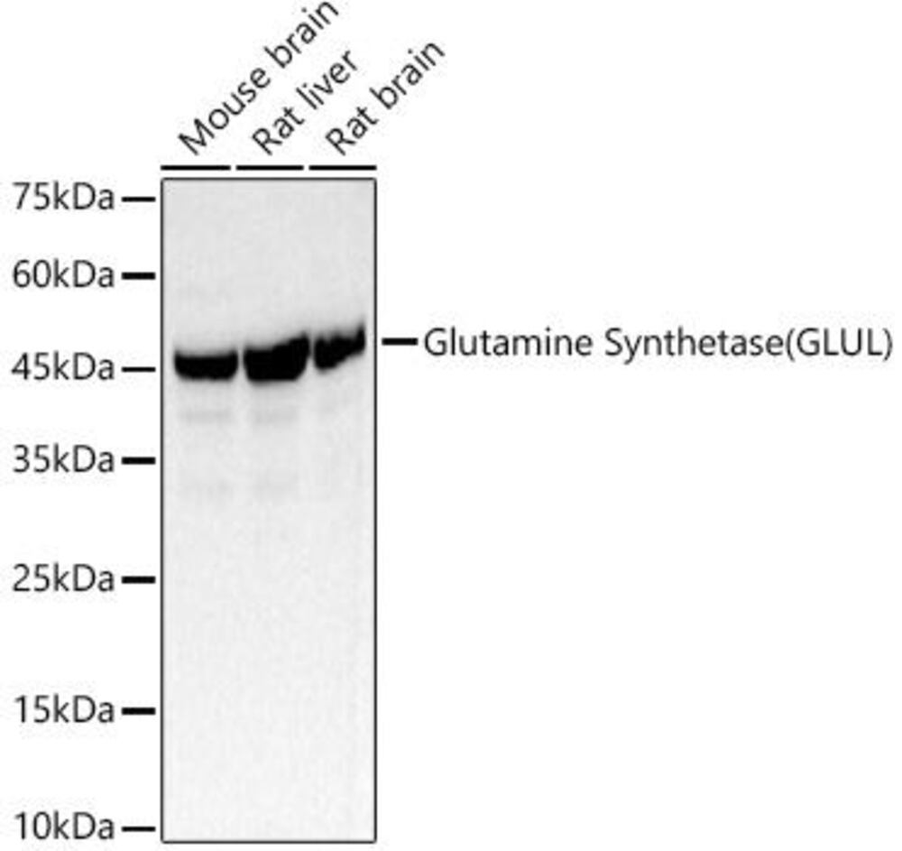 Anti-Glutamine Synthetase Antibody