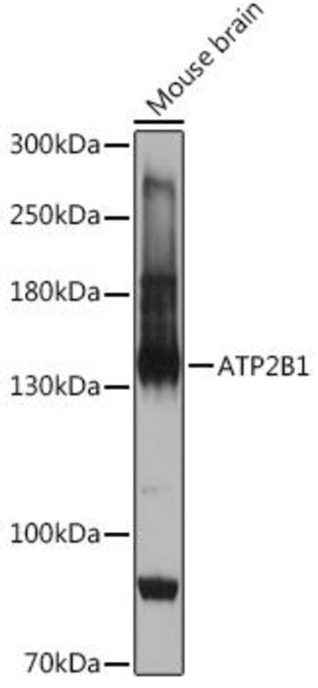 Anti-PMCA1 Antibody, 100 µl