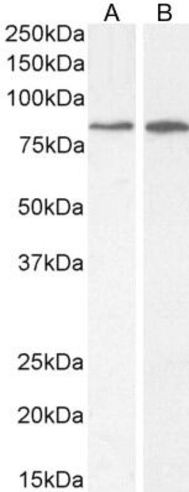 Anti-PLC-delta-3 Antibody