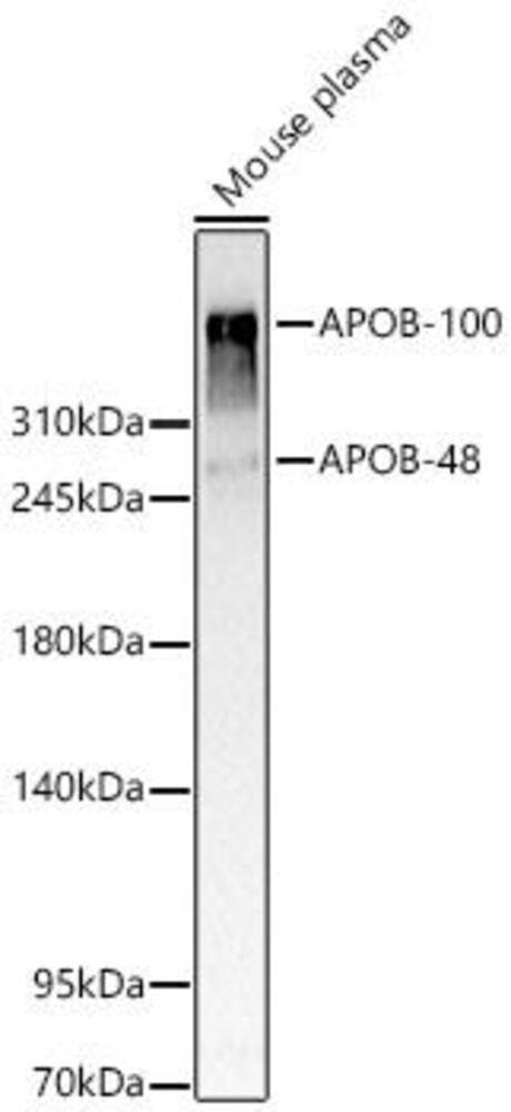 Anti-APOB Antibody, 100 µl