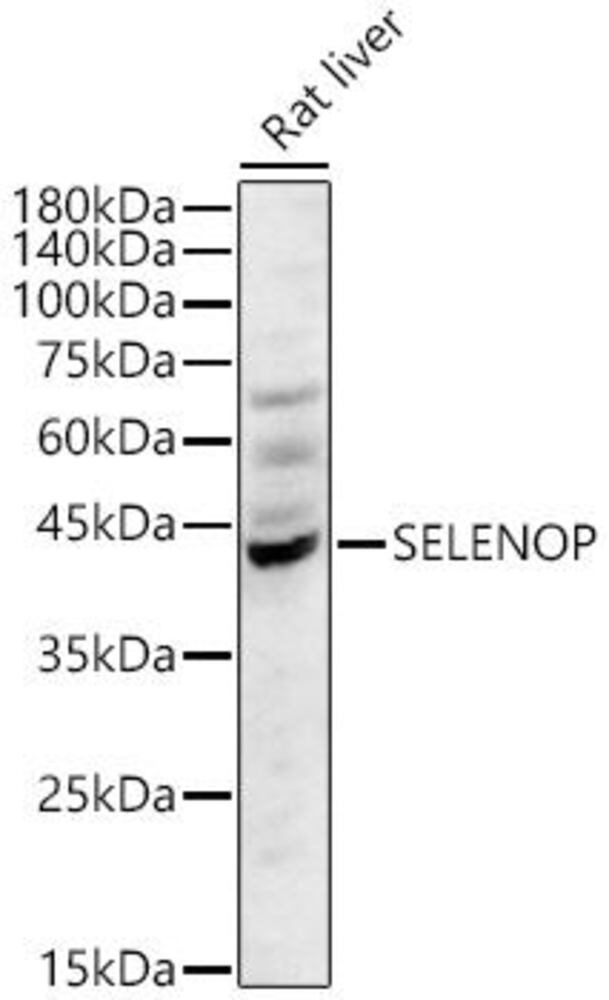 Anti-SEPP1 Antibody