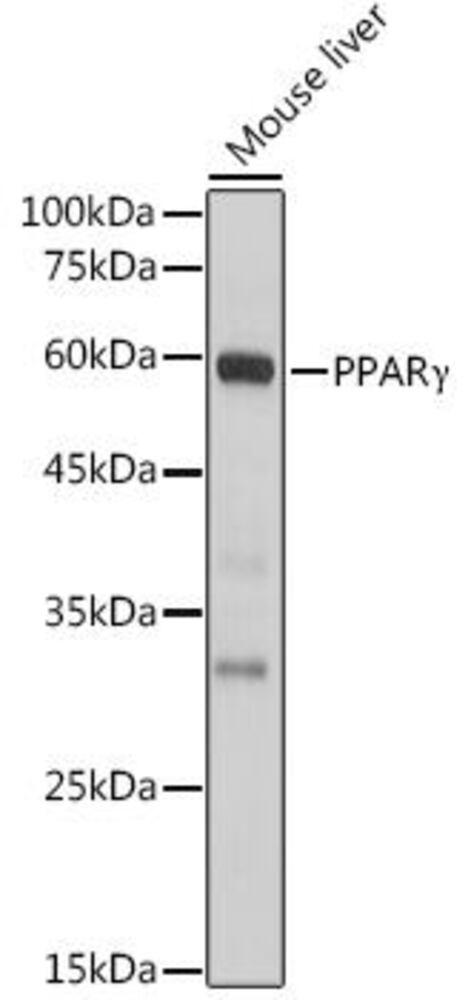 Anti-PPAR gamma Antibody