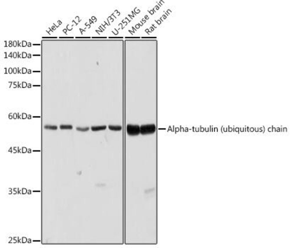 Anti-Tubulin Antibody