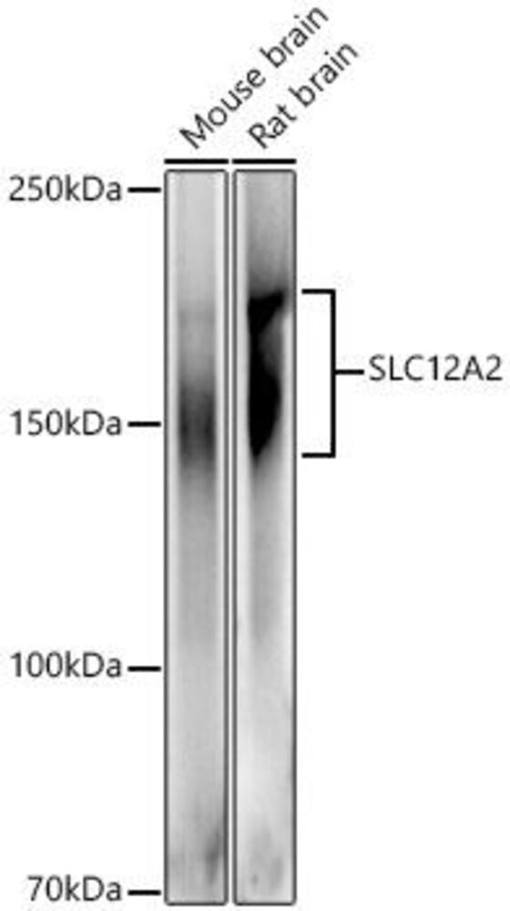 Anti-NKCC1 Antibody, 100 µl