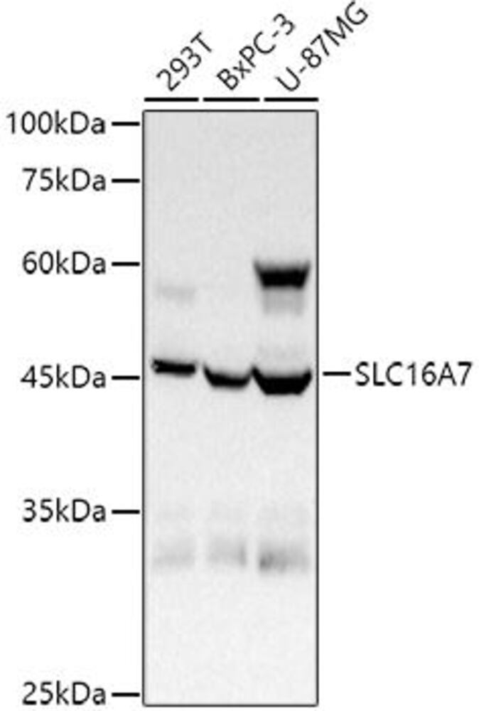 Anti-MCT2 Antibody