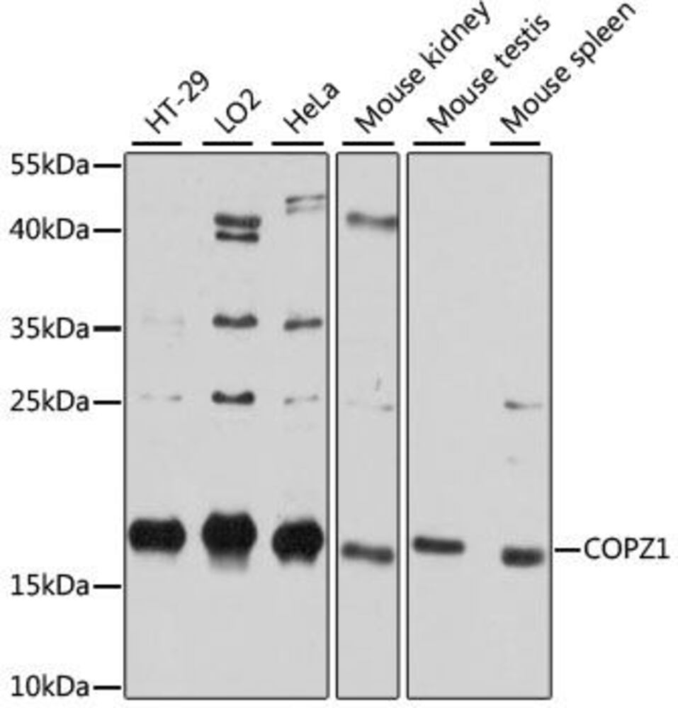 Anti-COPZ1 Antibody