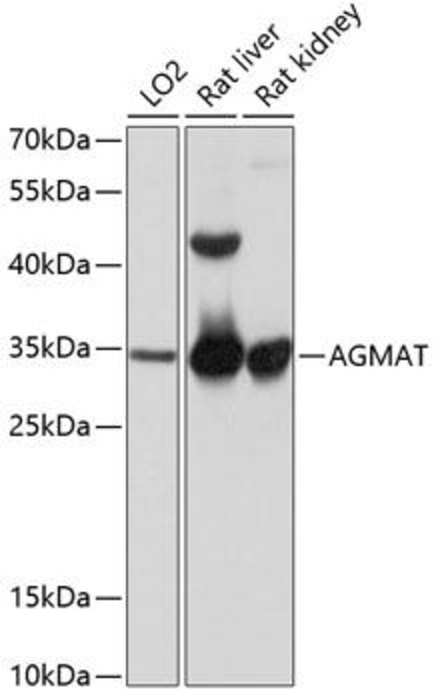 Anti-AGMAT Antibody, 100 µl